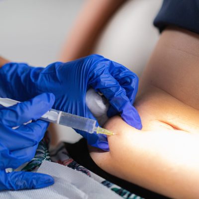 Aesthetic Medicine Lipolysis. Woman having lipolysis belly treatment